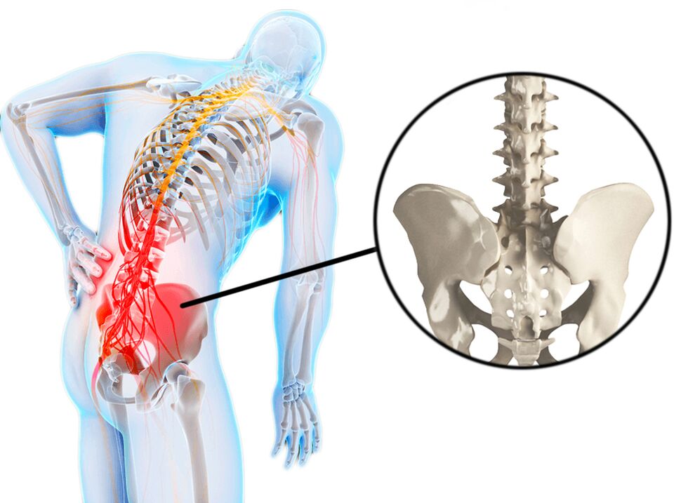 Spinal pathologies are a common cause of low back pain