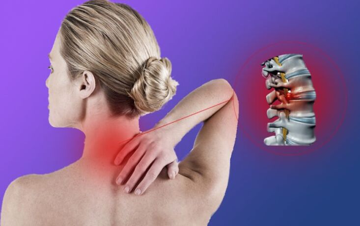 Spine inflammation with cervical osteochondrosis