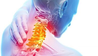 Causes of cervical osteochondrosis