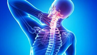 Complications of cervical spine osteochondrosis