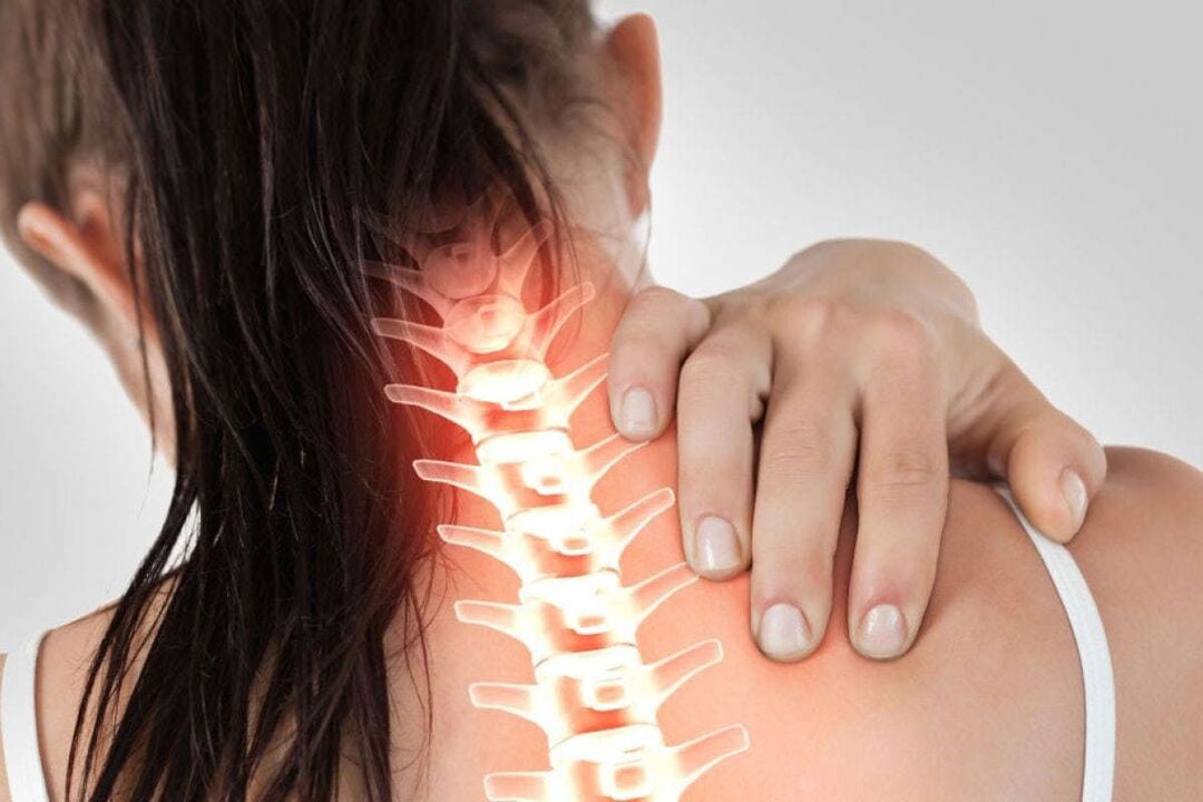 Cervical osteochondrosis manifestations